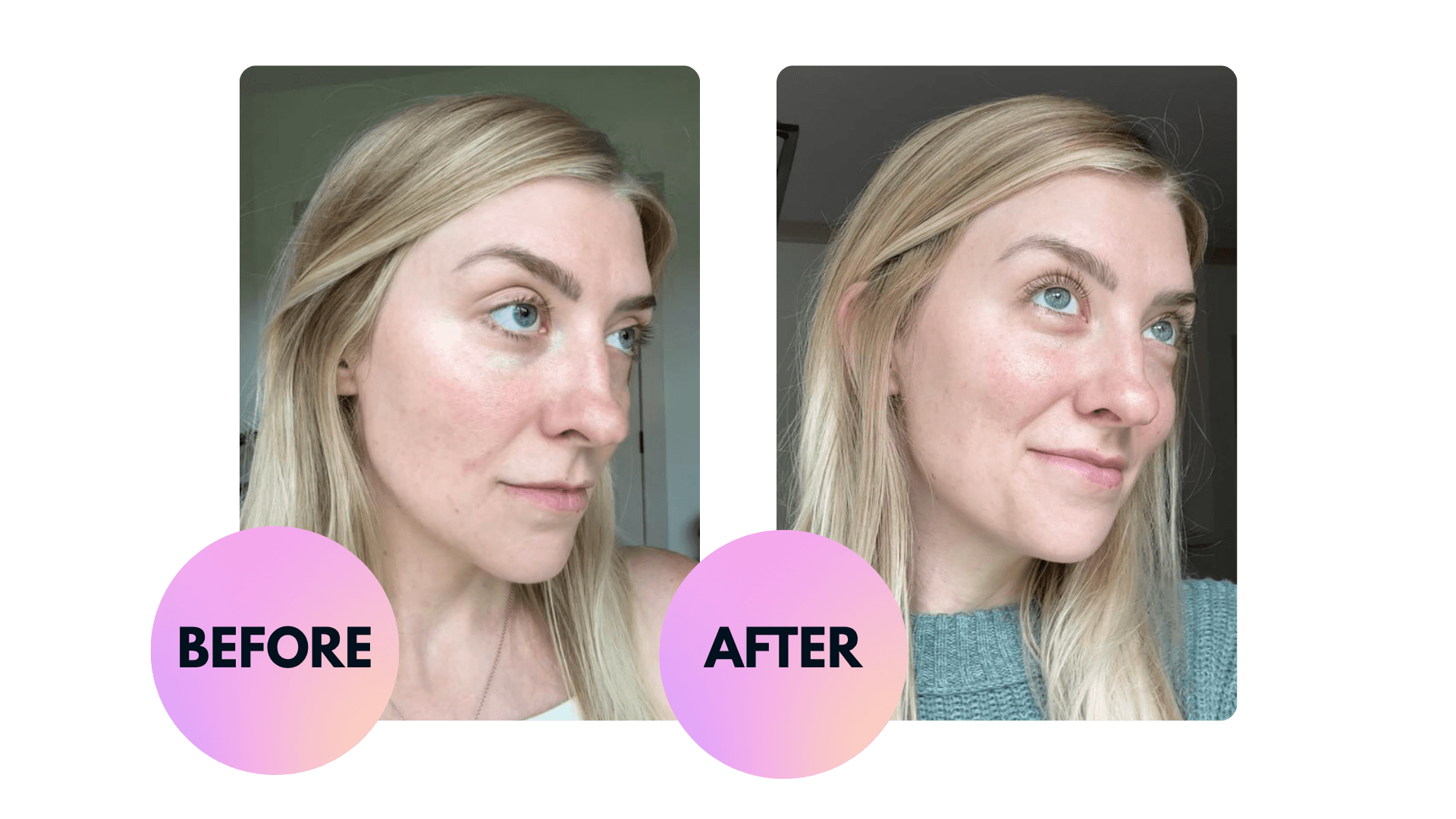 Sephora katini before and after
